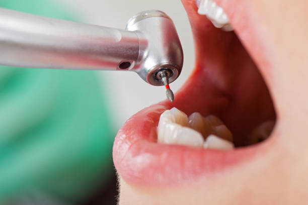 Best Emergency Treatment for Oral Infections in Clearwater, SC